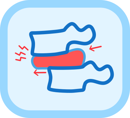 Icono espondilolistesis