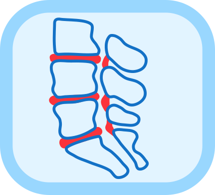 Icono estenosis espinal